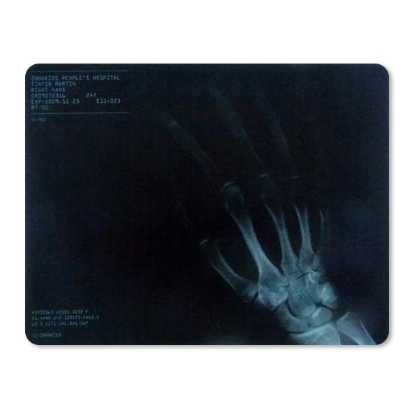 Hand X-ray Computer Mouse Pad